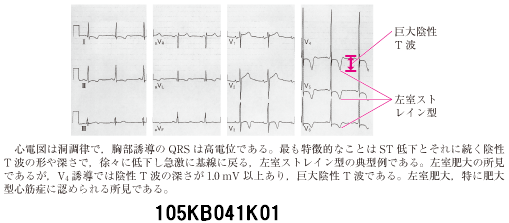 105B41 | 肥大型心筋症 国試 | M3E Medical 105B41 | 肥大型心筋症 国試 | M3E Medical