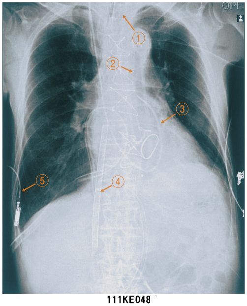 111E48 国試 | M3E Medical 111E48 国試 | M3E Medical