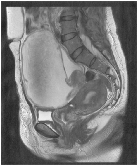 腹部のMRI 116D52 | 卵巣腫瘍 国試 | テコプラ