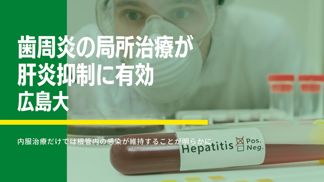 歯周治療が非アルコール性脂肪性肝炎の病態進行を抑制する 広島大の画像です
