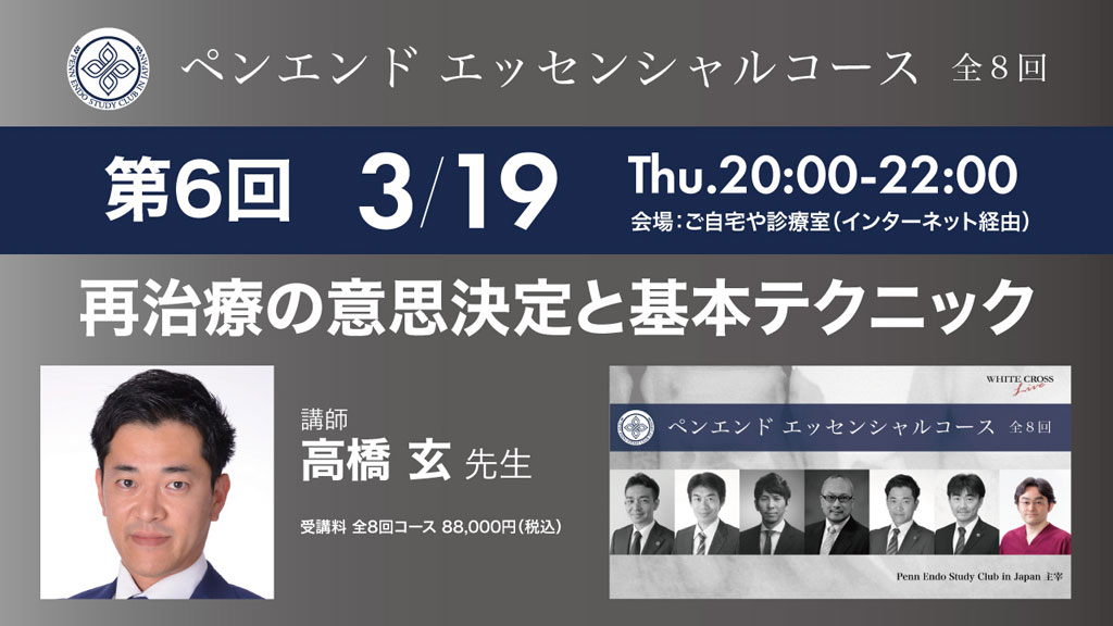 【3/19 Live開催】PESCJ髙橋玄先生『再治療の意思決定と基本テクニック』予告編の画像です