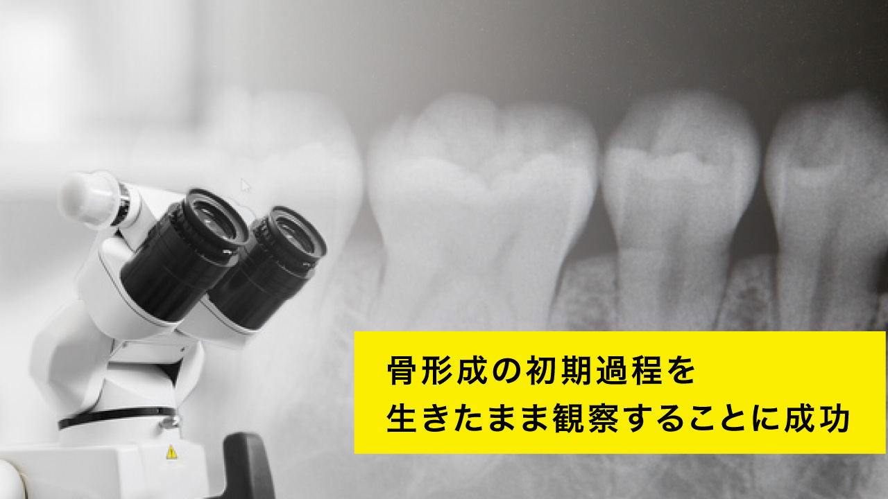骨形成の初期過程を生きたまま観察することに成功 大阪大の画像です