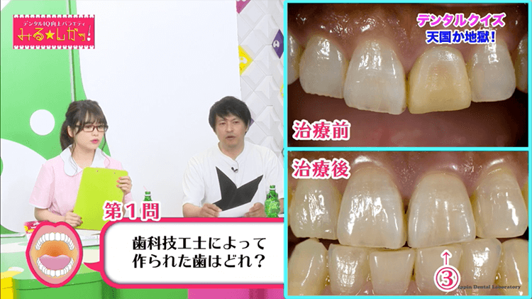 デンタルIQ向上バラエティ「デンタルIQ向上バラエティ みる★しかッ!#2」 を AbemaFRESH!にて視聴できます!