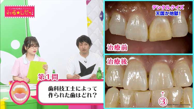 デンタルIQ向上バラエティ「デンタルIQ向上バラエティ みる★しかッ!#2」 を AbemaFRESH!にて視聴できます!の画像です