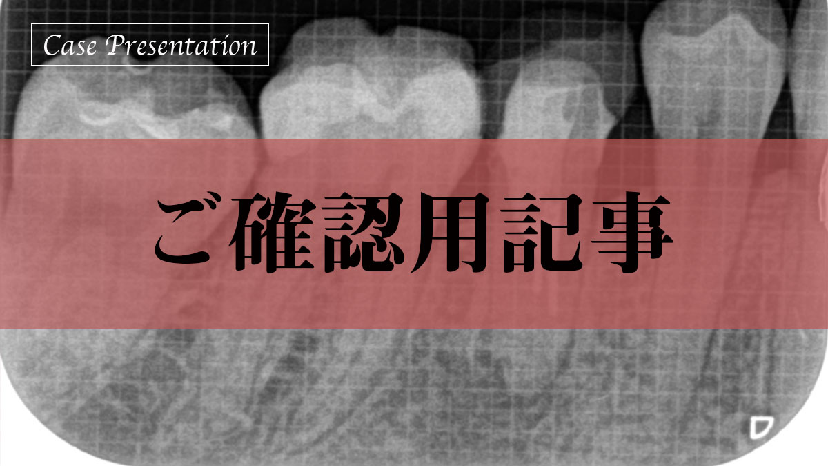 未処置根管を有する歯に対し歯内療法を行った一症例