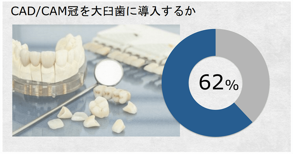 CAD/CAM冠を大臼歯に適応すべきか-過半数の歯科医が慎重意見