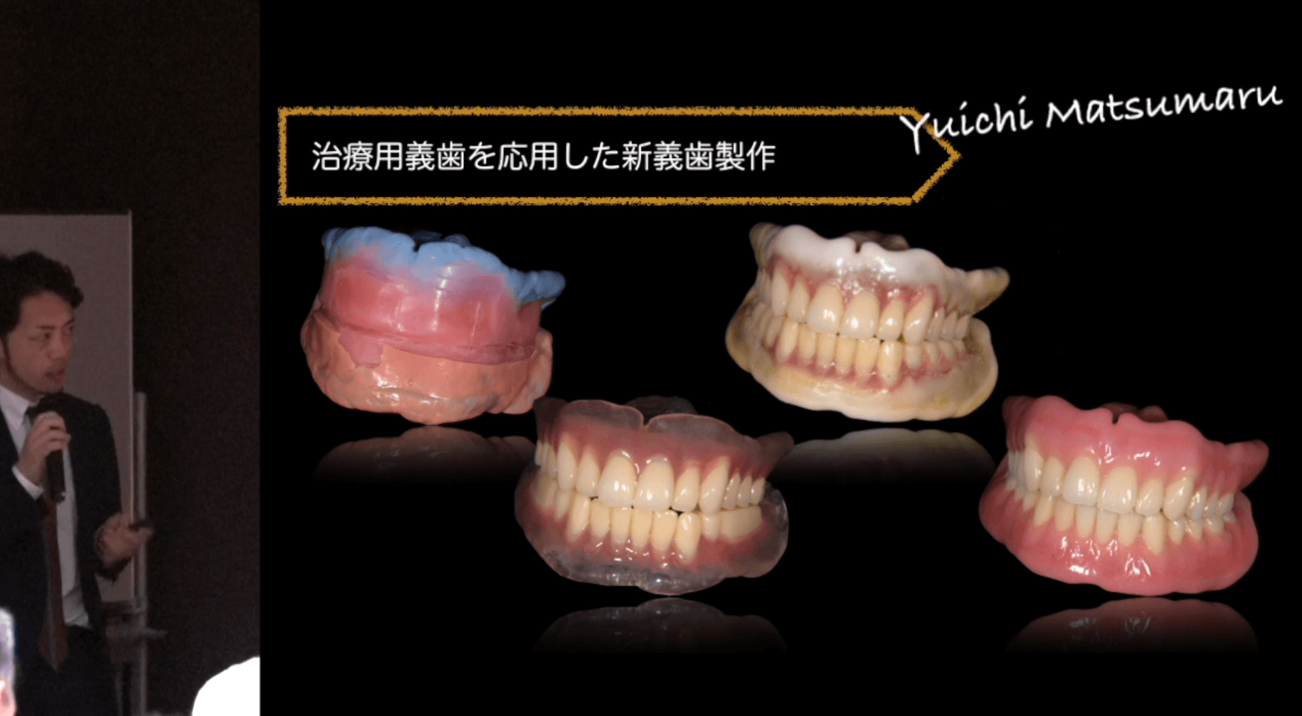 松丸 悠一先生『失敗しない総義歯臨床へのヒント』 第1回 〜総義歯治療専門歯科医師として〜