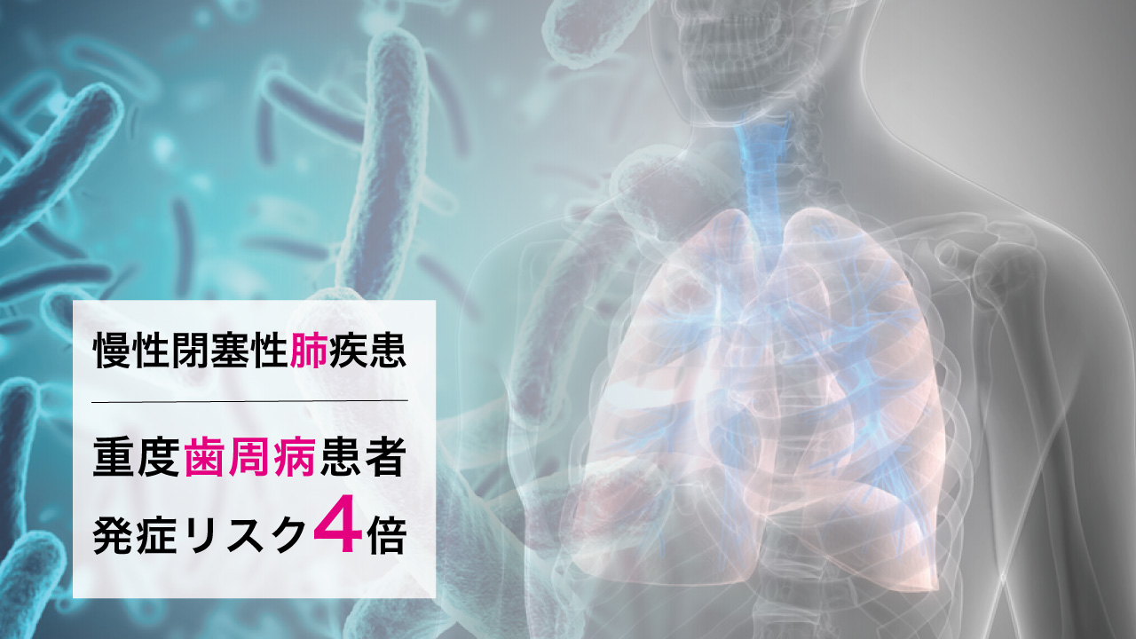 重度歯周病患者は慢性閉塞性肺疾患(COPD)を発症するリスクが約4倍　九州大の画像です