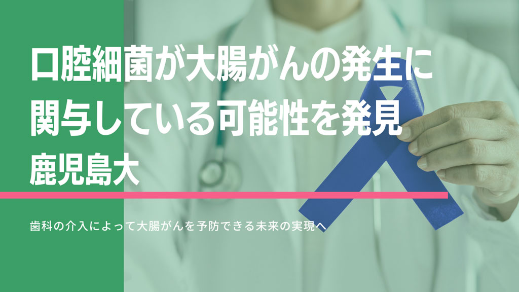 口腔細菌が大腸がんの発生に関与している可能性を発見 鹿児島大の画像です