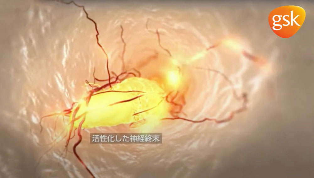 ご存知でしたか?3人に1人が悩んでいる象牙質知覚過敏のことの画像です