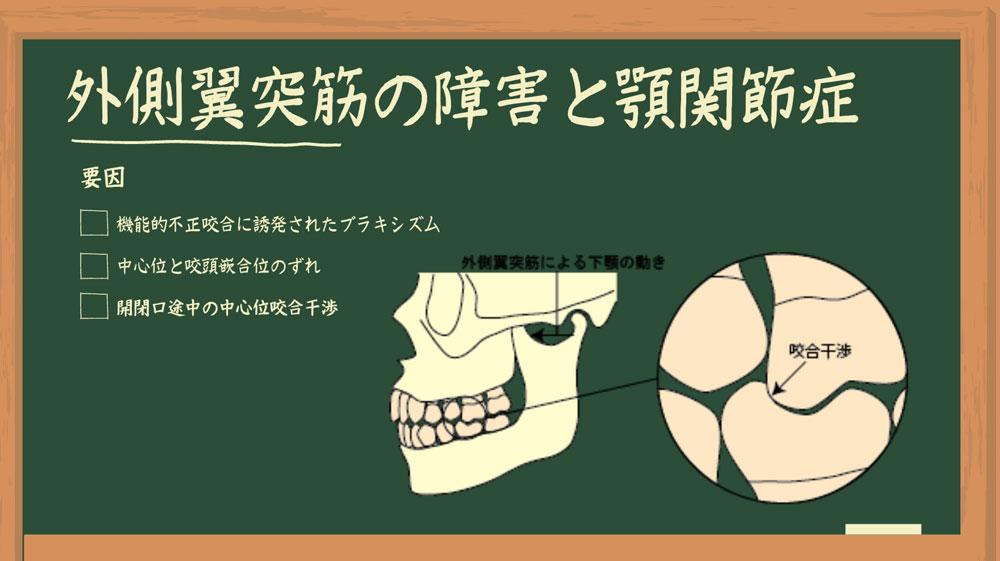 Dr.外川のやさしい補綴講義#6「外側翼突筋の障害と顎関節症」の画像です