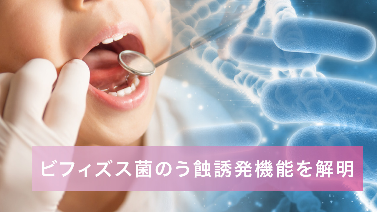 ビフィズス菌のう蝕誘発機能を解明 東北大の画像です