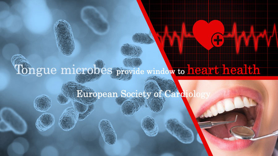 舌表面の細菌叢による心不全の診断　欧州心臓学会の画像です
