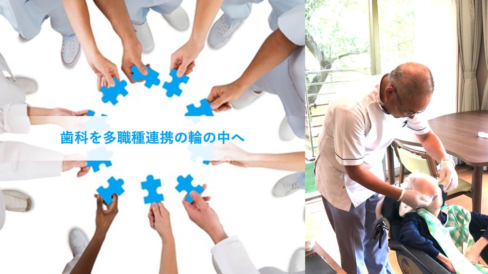 歯科を多職種連携の輪の中へ 「立川モデル」山下美登先生インタビュー 前編の画像です