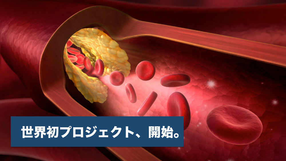 う蝕・歯周病と脳卒中・認知症の関連を検証する世界初の共同研究を開始 国立循環器病研究センターの画像です