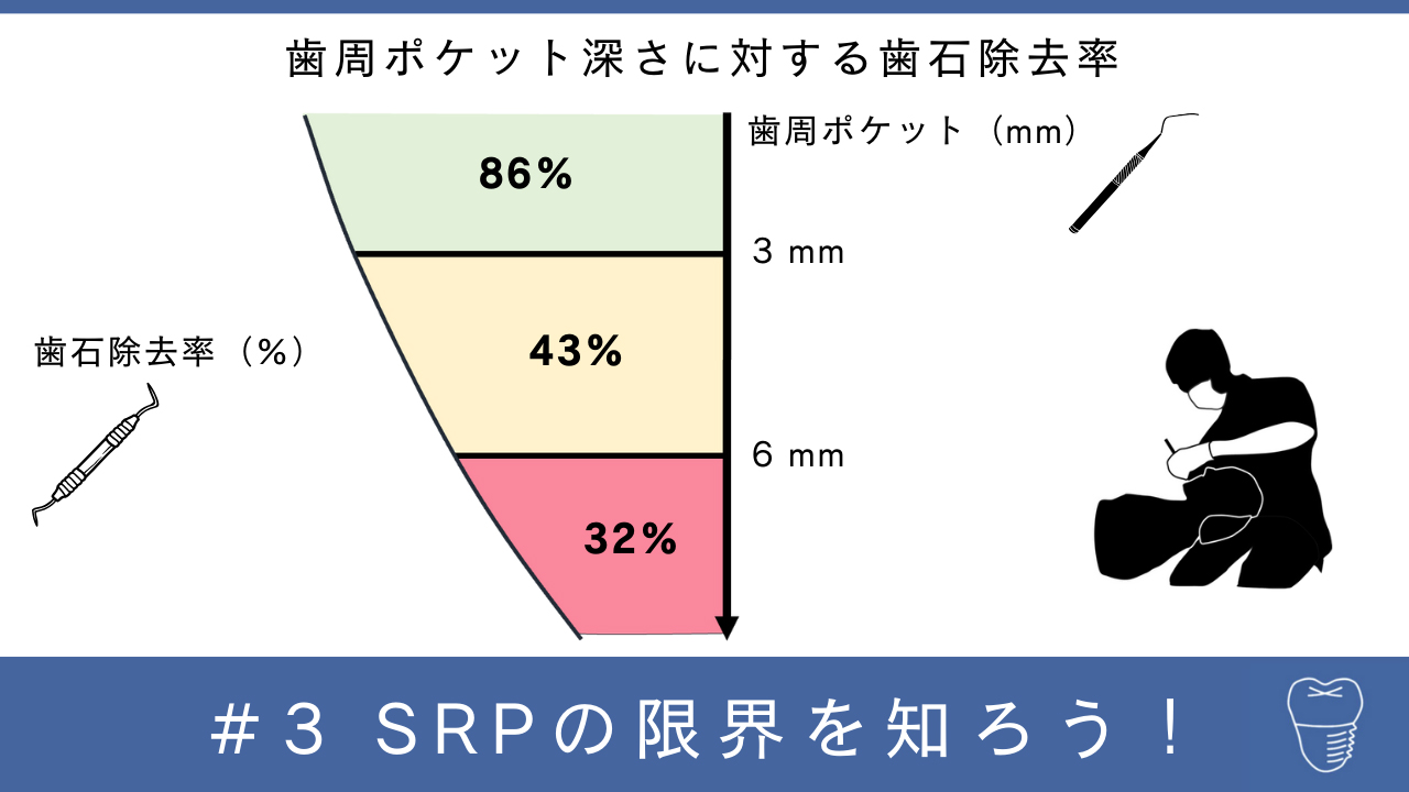 歯周病患者に根拠のある患者指導がしたい！ 第3回「SRPの限界を知ろう！」