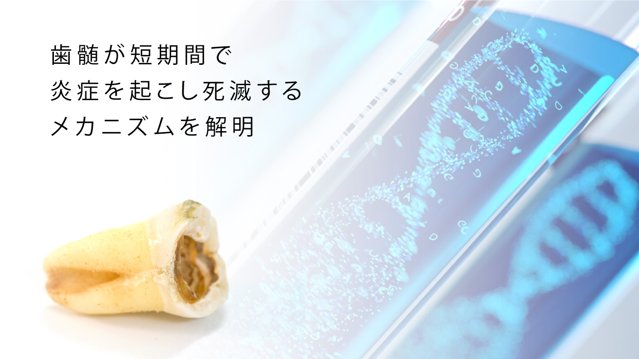 歯髄が短期間で炎症を起こし死滅するメカニズムを世界で初めて解明 九州大の画像です