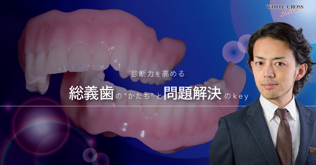 診断力を高める!総義歯の“かたち”と問題解決のKey
【ライブセミナー】の画像です