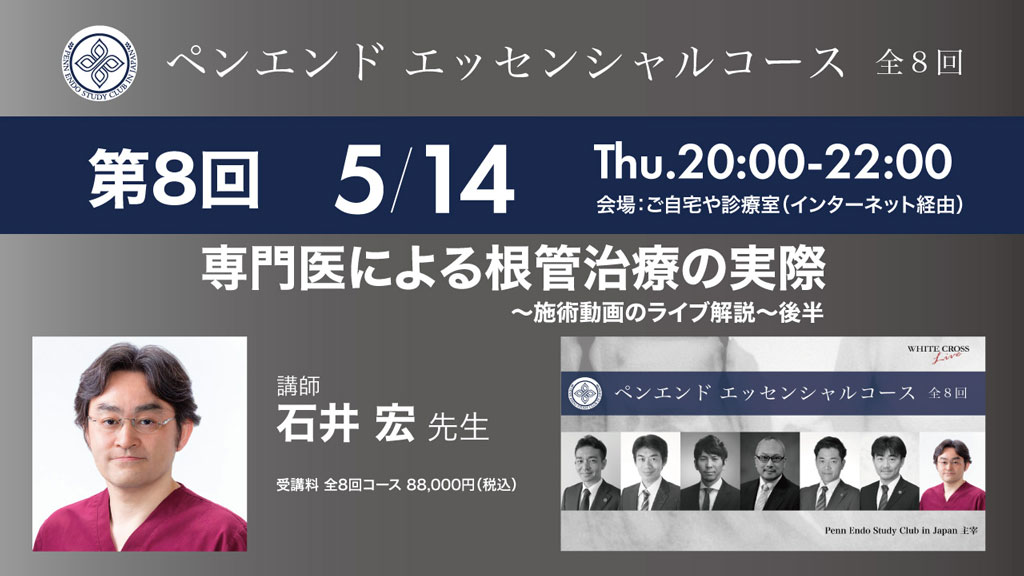 【5/14 Live開催】ついに最終回『専門医による根管治療の実際〜施術動画のライブ解説〜』予告編の画像です