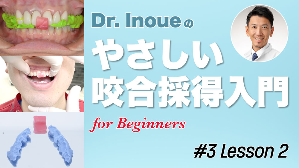 #3 Lesson 2「セントリックバイトによる咬合採得」の画像です