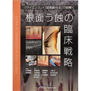 根面う蝕の臨床戦略の画像です