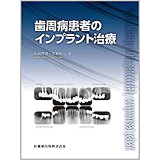 歯周病患者のインプラント治療の画像です