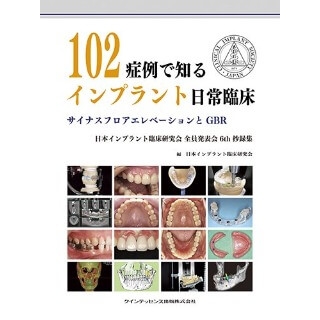 102症例で知るインプラント日常臨床の画像です