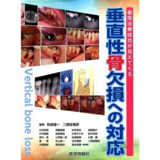 垂直性骨欠損への対応 歯周治療成功が見えてくるの画像です