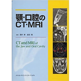 顎・口腔のCT・MRIの画像です