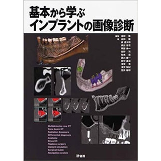 基本から学ぶインプラントの画像診断の画像です