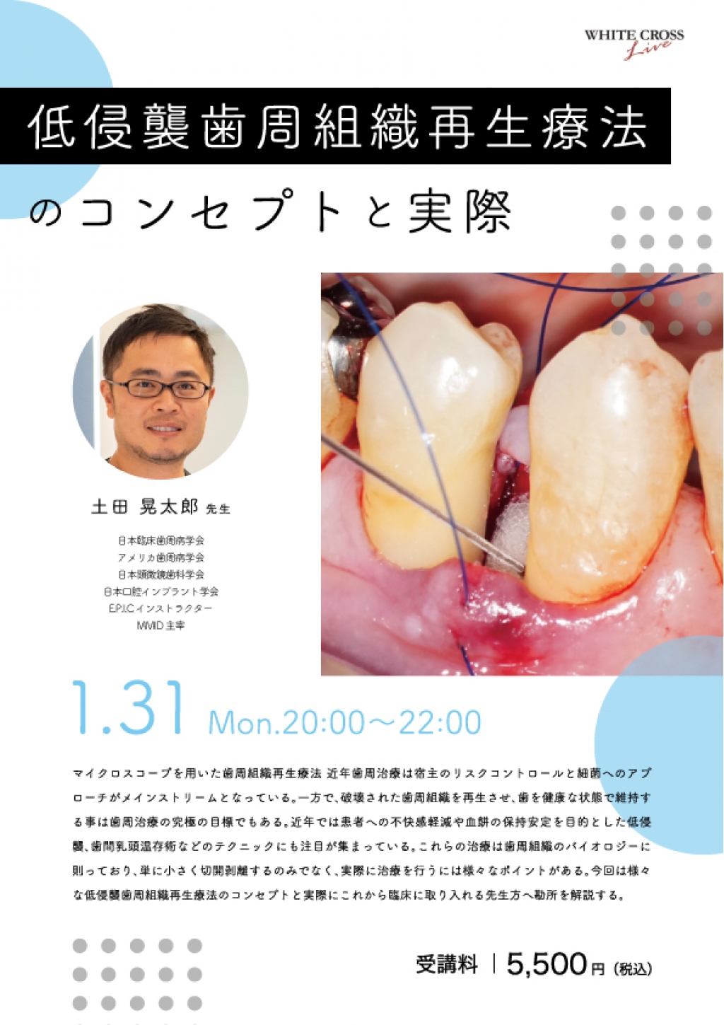 186  イラスト・写真・動画で学ぶ!低侵襲 歯周組織再生療法 イラスト・写真・動画で学ぶ!低侵襲歯周組織再生療法/山口文誉