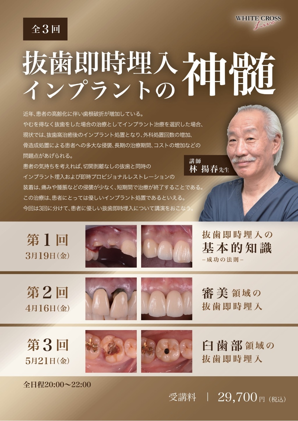 Dr.皆川の 基礎編４審美インプラント 【 抜歯即時埋入編 】【全2巻】 Dr.皆川の 基礎編4審美インプラント 【 抜歯即時埋入編 】【全2巻】