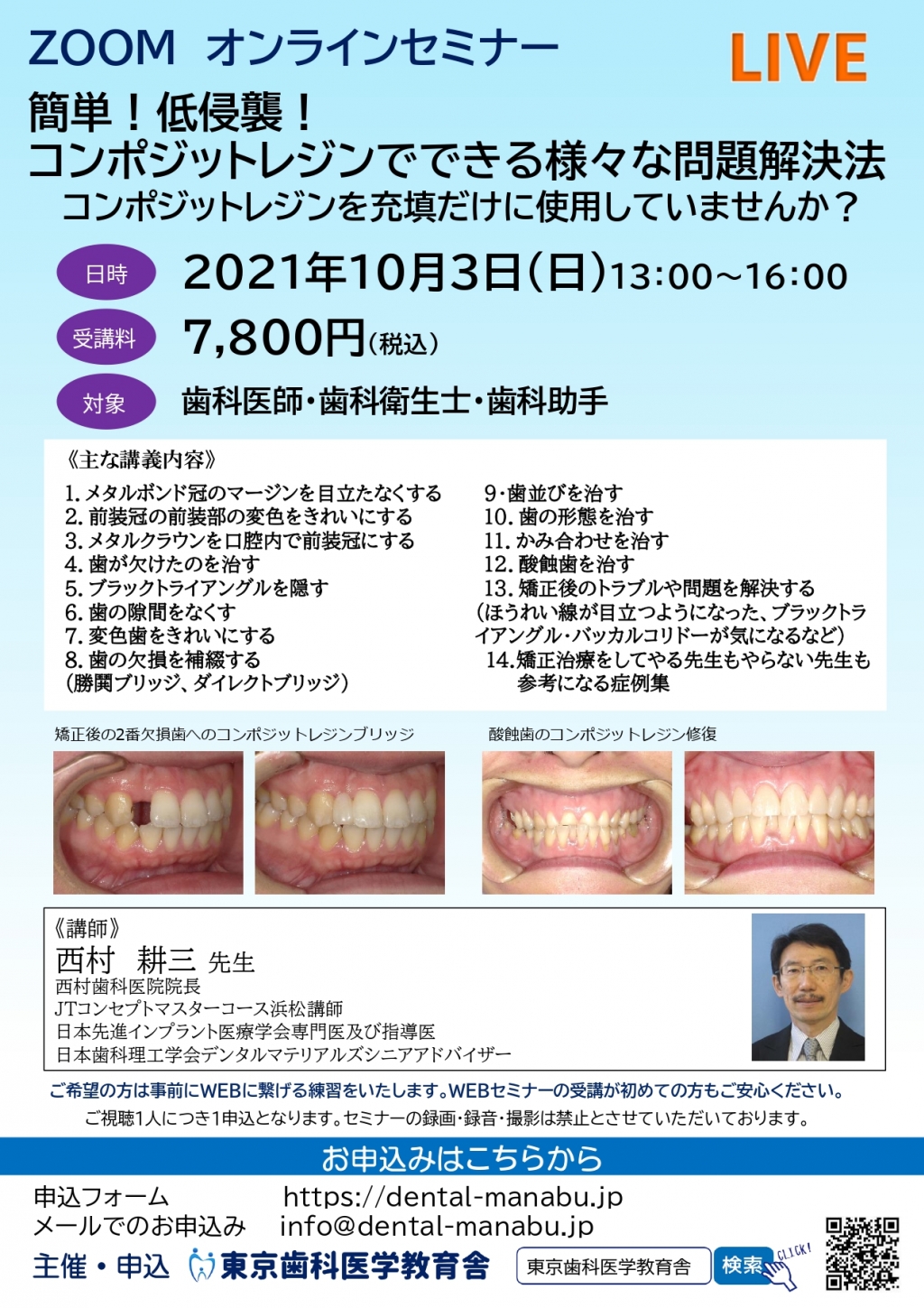 簡単！低侵襲！コンポジットレジンでできる様々な問題解決法の画像です