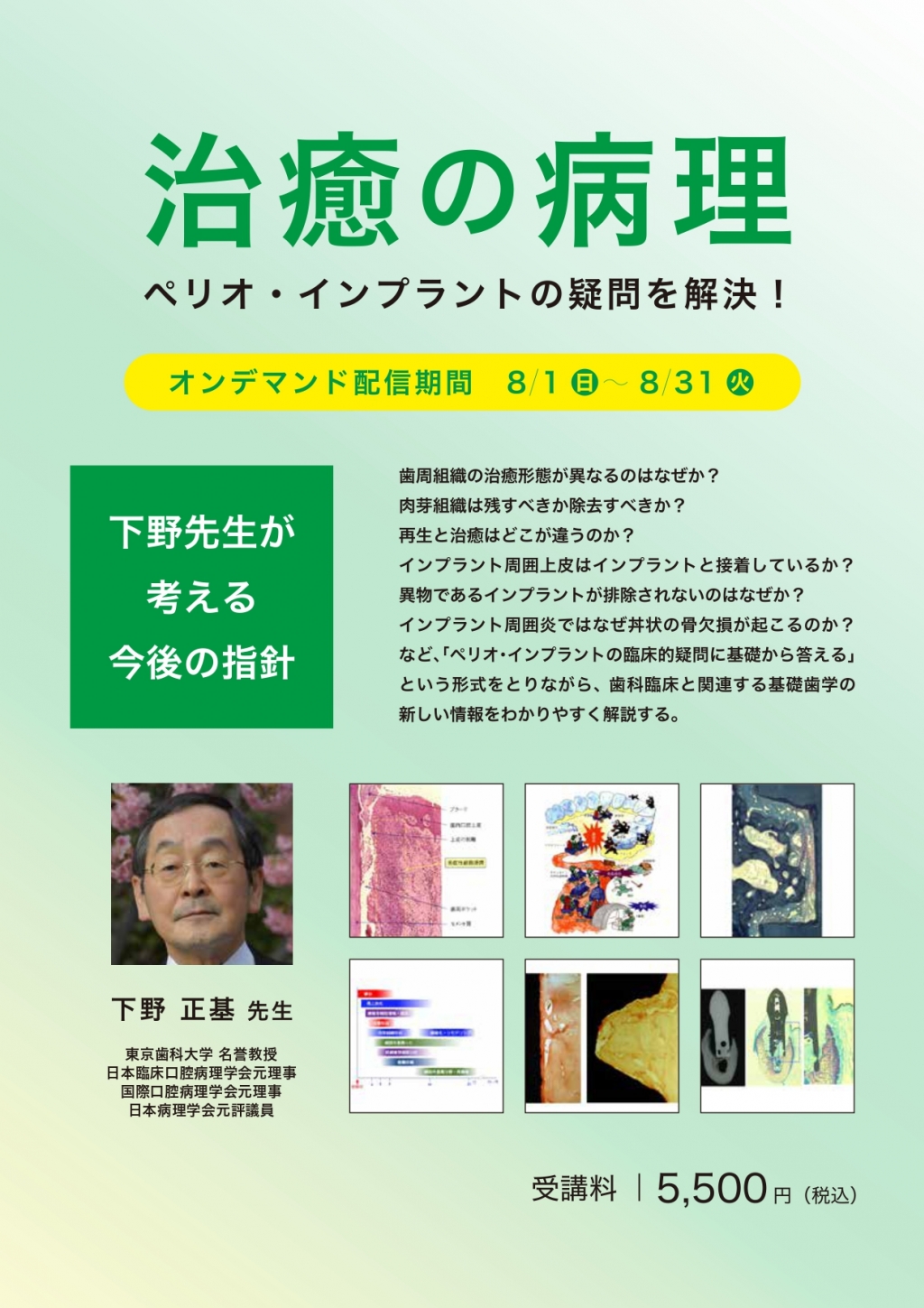 50 Off 下野先生に聞いてみた 1 ペリオ インプラントの疑問に答える 指針がわかる下野正基 今だけ限定価格 Farazyhospitalnatunbazar Com