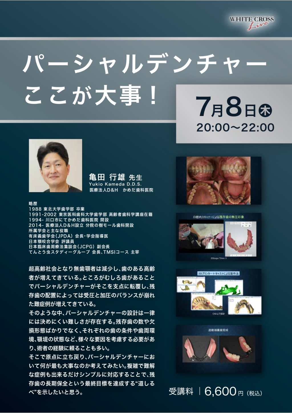 Live パーシャルデンチャー ここが大事 Whitecrossの歯科セミナー情報
