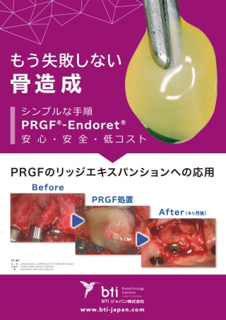 もう失敗しない骨造成の画像です