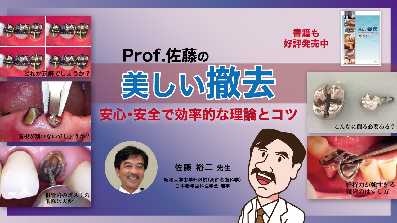 Prof.佐藤の美しい撤去の画像です