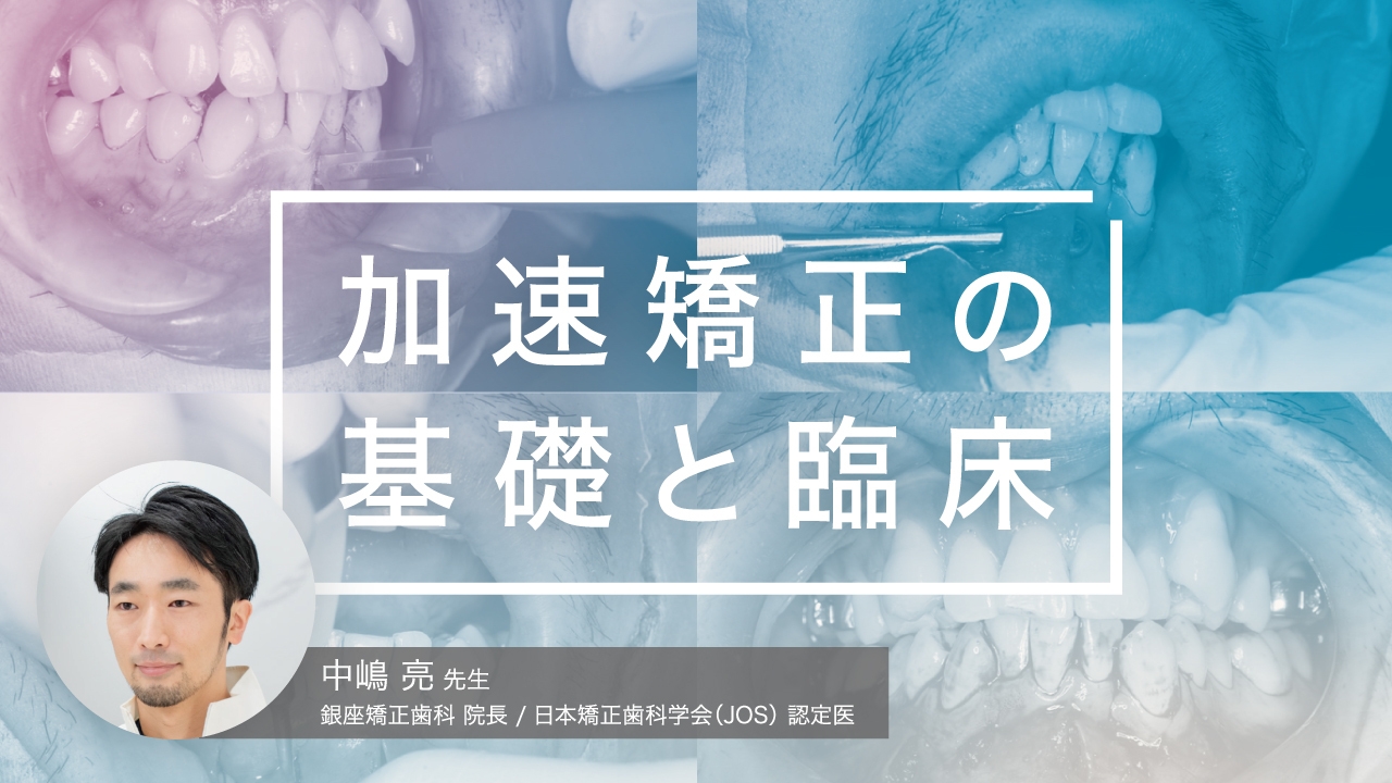 加速矯正の基礎と臨床の画像です