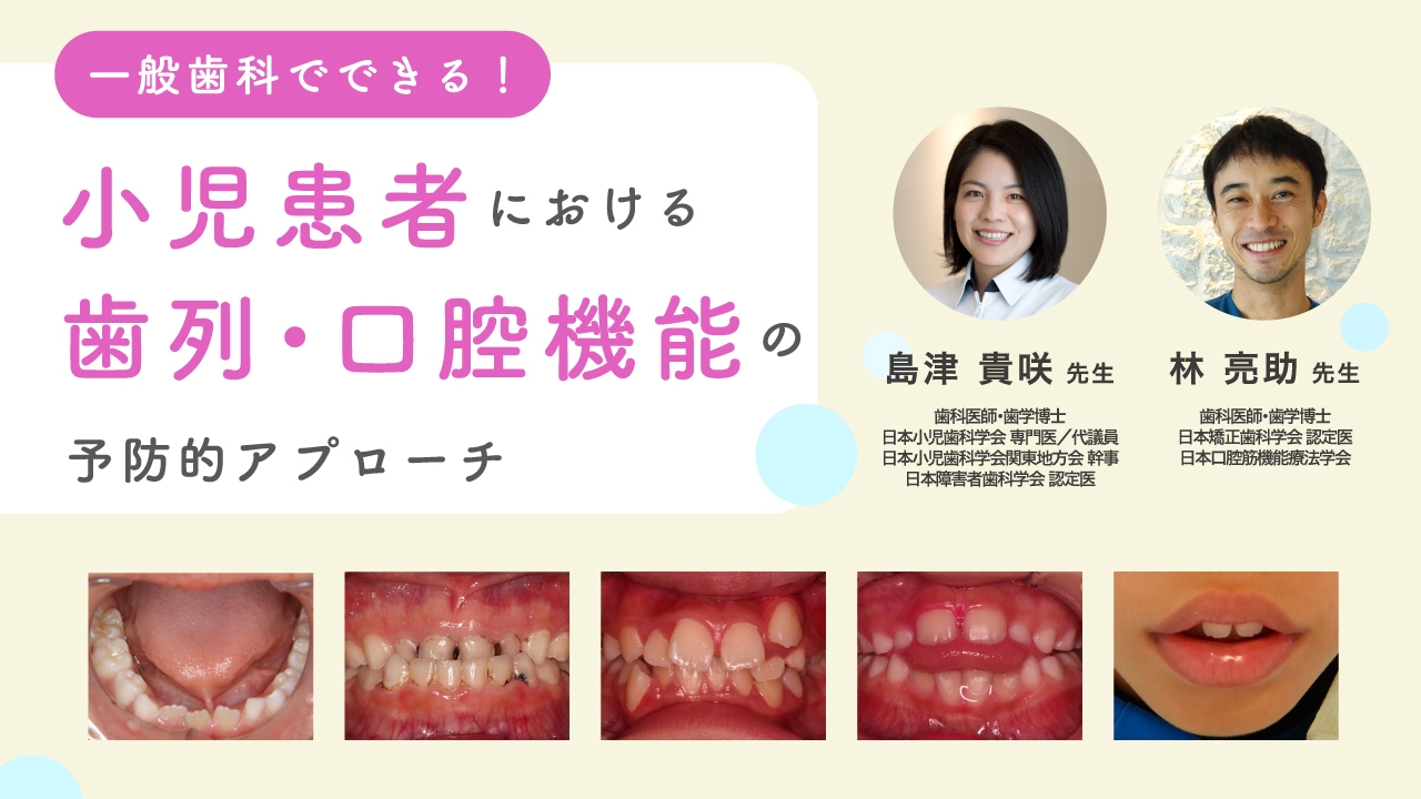 一般歯科でできる!小児患者における歯列・口腔機能の予防的アプローチの画像です
