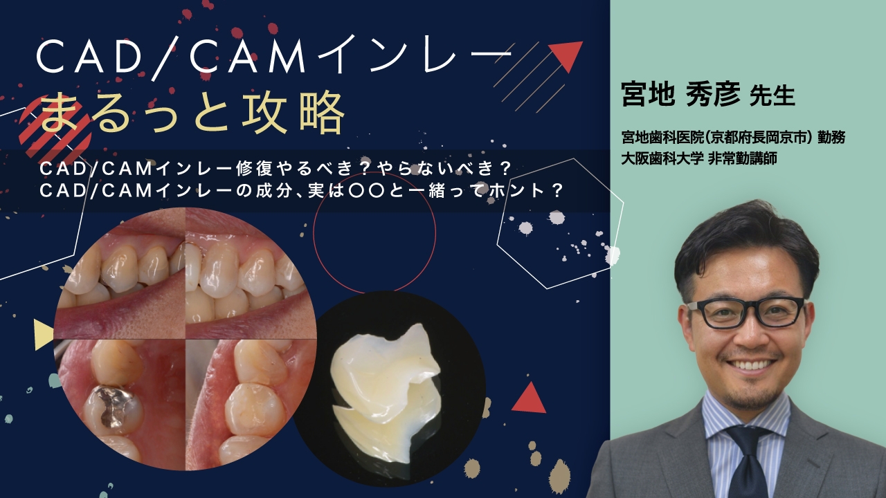 CAD/CAMインレーまるっと攻略の画像です