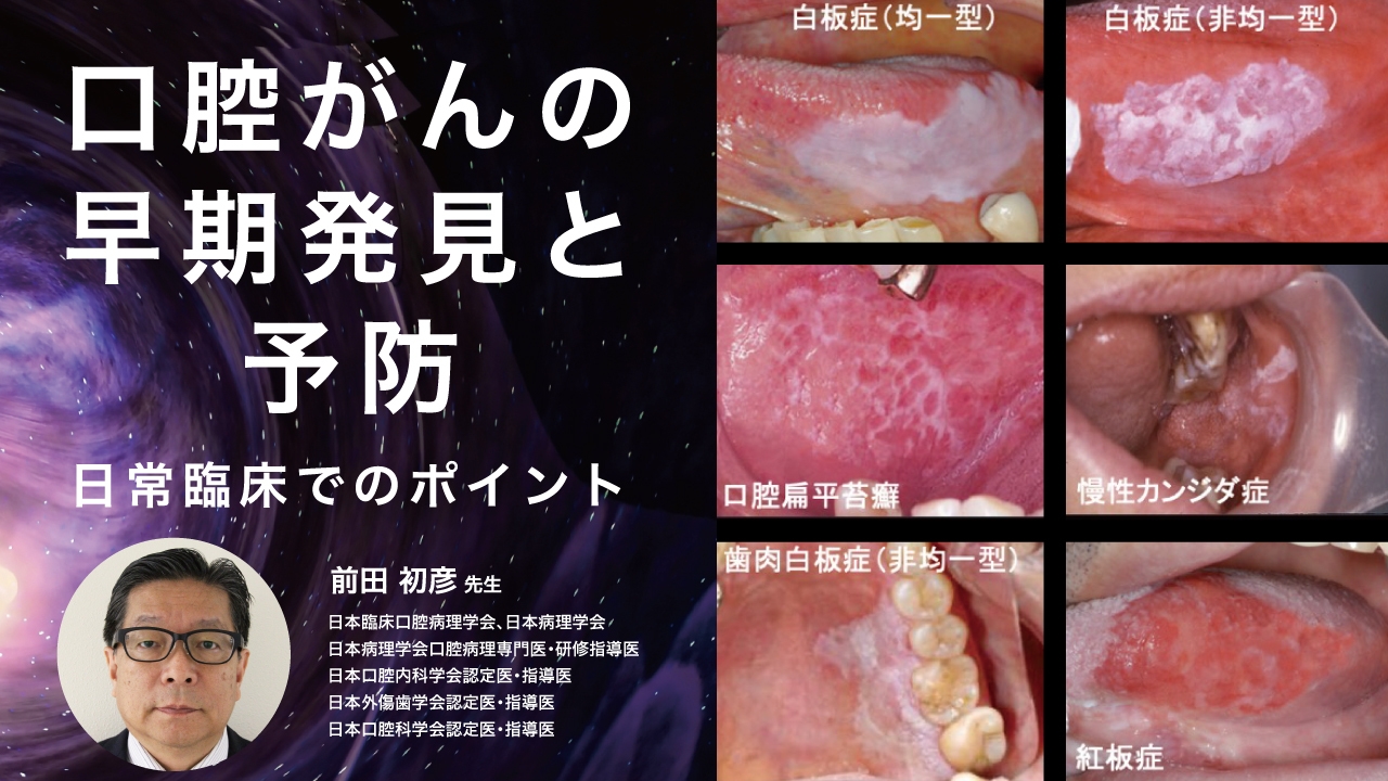 口腔がん症状写真 | 口腔がん 初期症状 写真 | 舌がんの症状とは?前兆やステージごとの症状、受診の目安を解説 – SEHQX