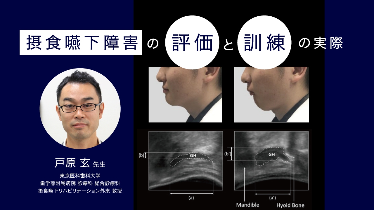 摂食嚥下障害の評価と訓練の実際の画像です