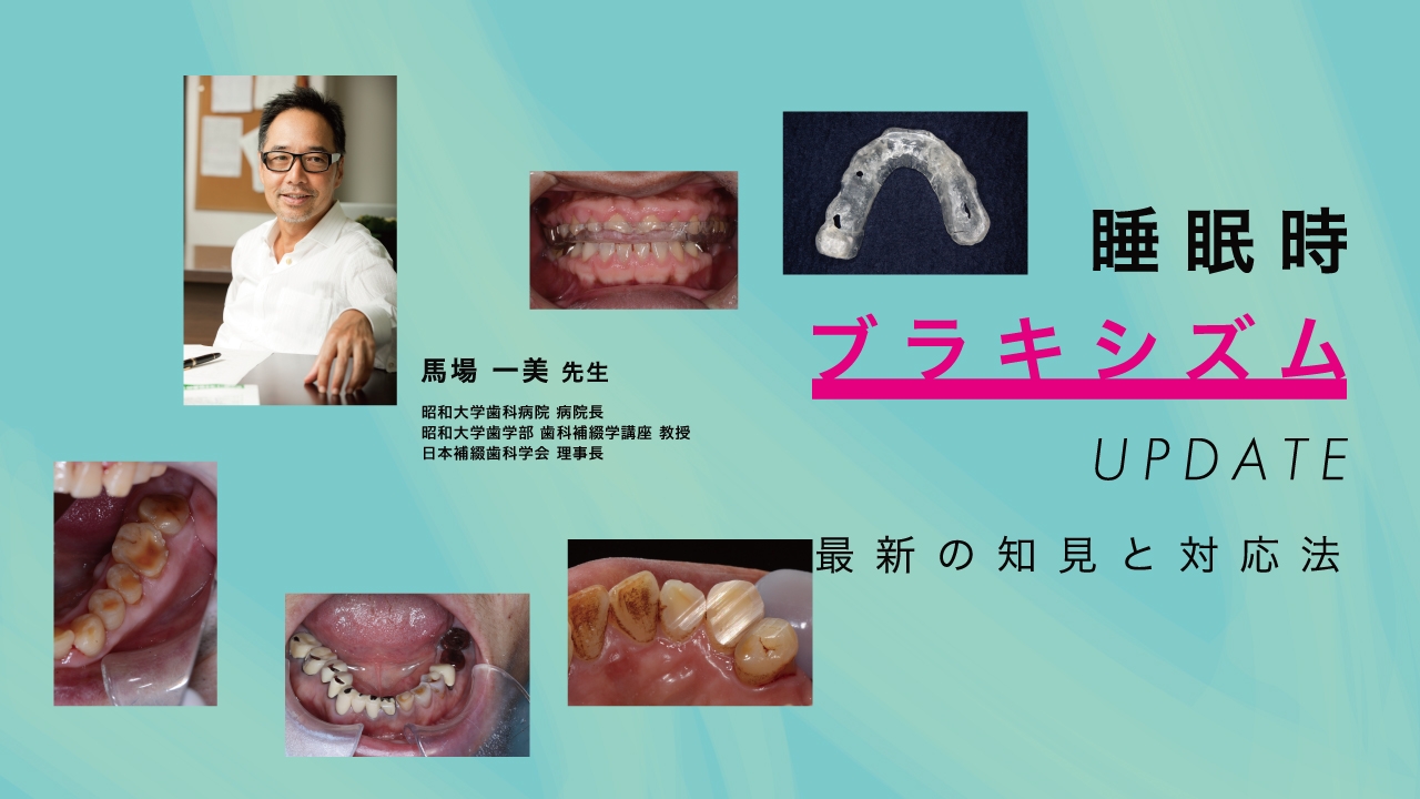 睡眠時ブラキシズムアップデート 〜最新の知見と対応方法〜の画像です