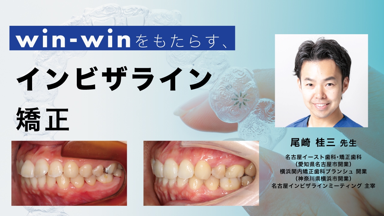 win-winをもたらす、インビザライン矯正の画像です