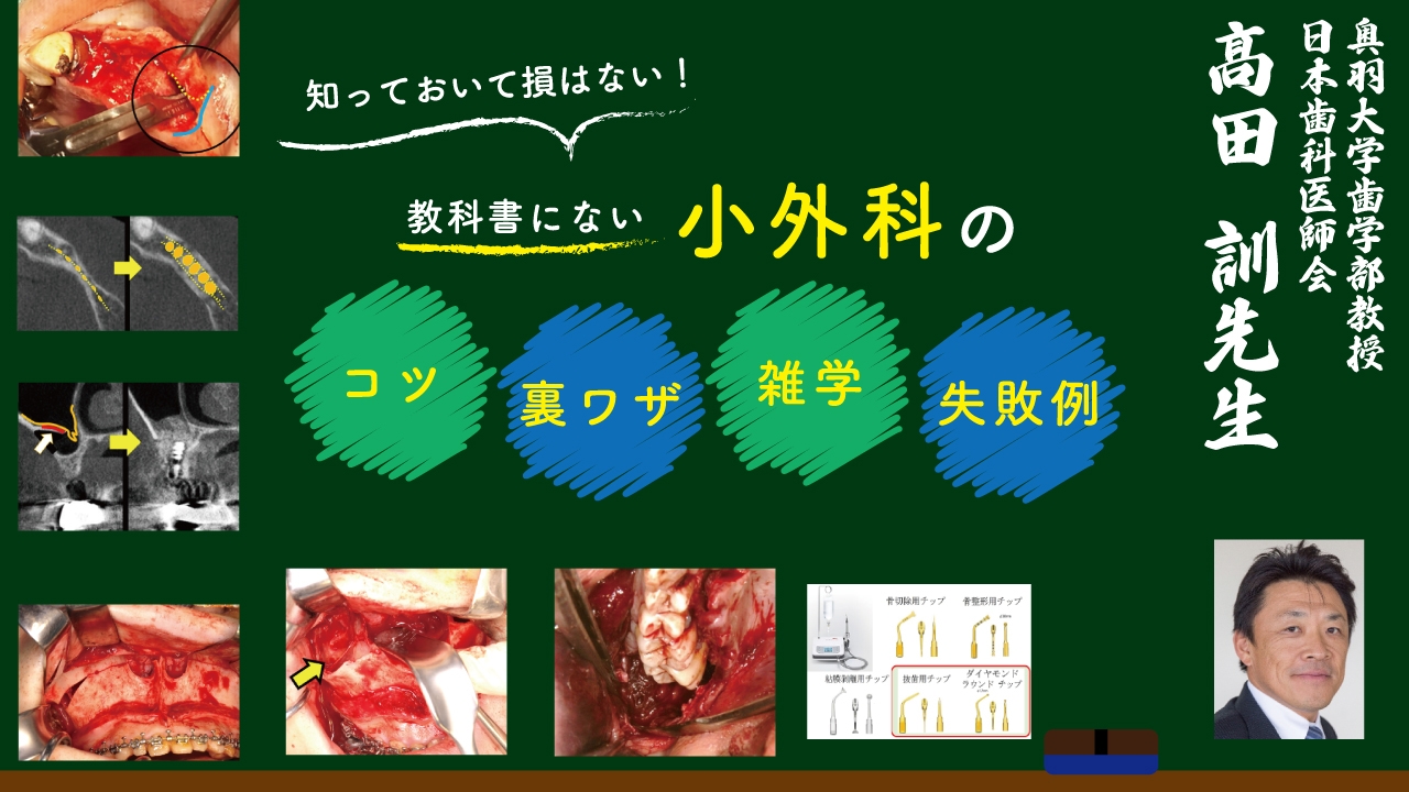 知っておいて損はない!教科書にない小外科のコツ・裏ワザ・雑学・失敗例の画像です