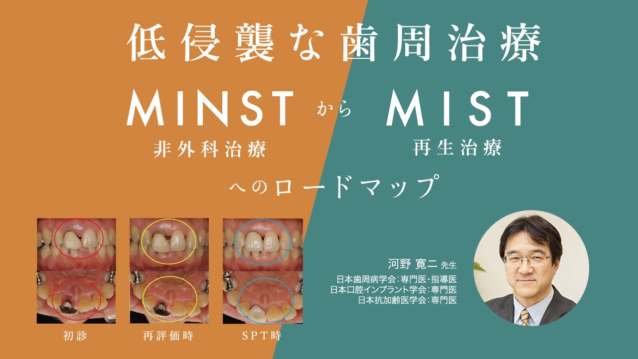 低侵襲な歯周治療:MINST(非外科治療)からMIST(再生治療)へのロードマップの画像です
