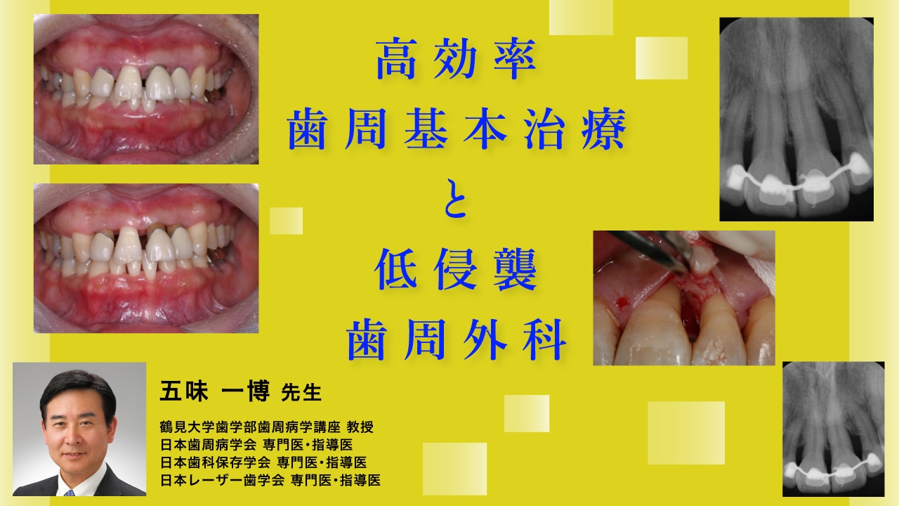 高効率歯周基本治療と低侵襲歯周外科の画像です