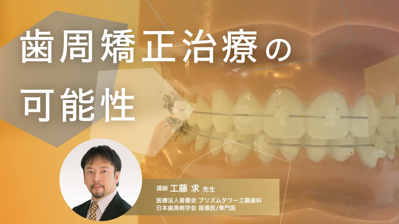 歯周矯正治療の可能性の画像です