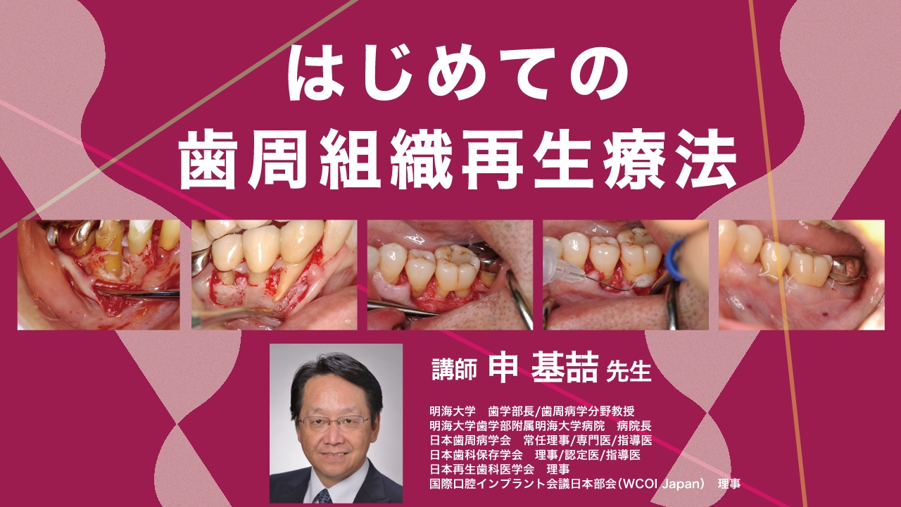 はじめての歯周組織再生療法の画像です