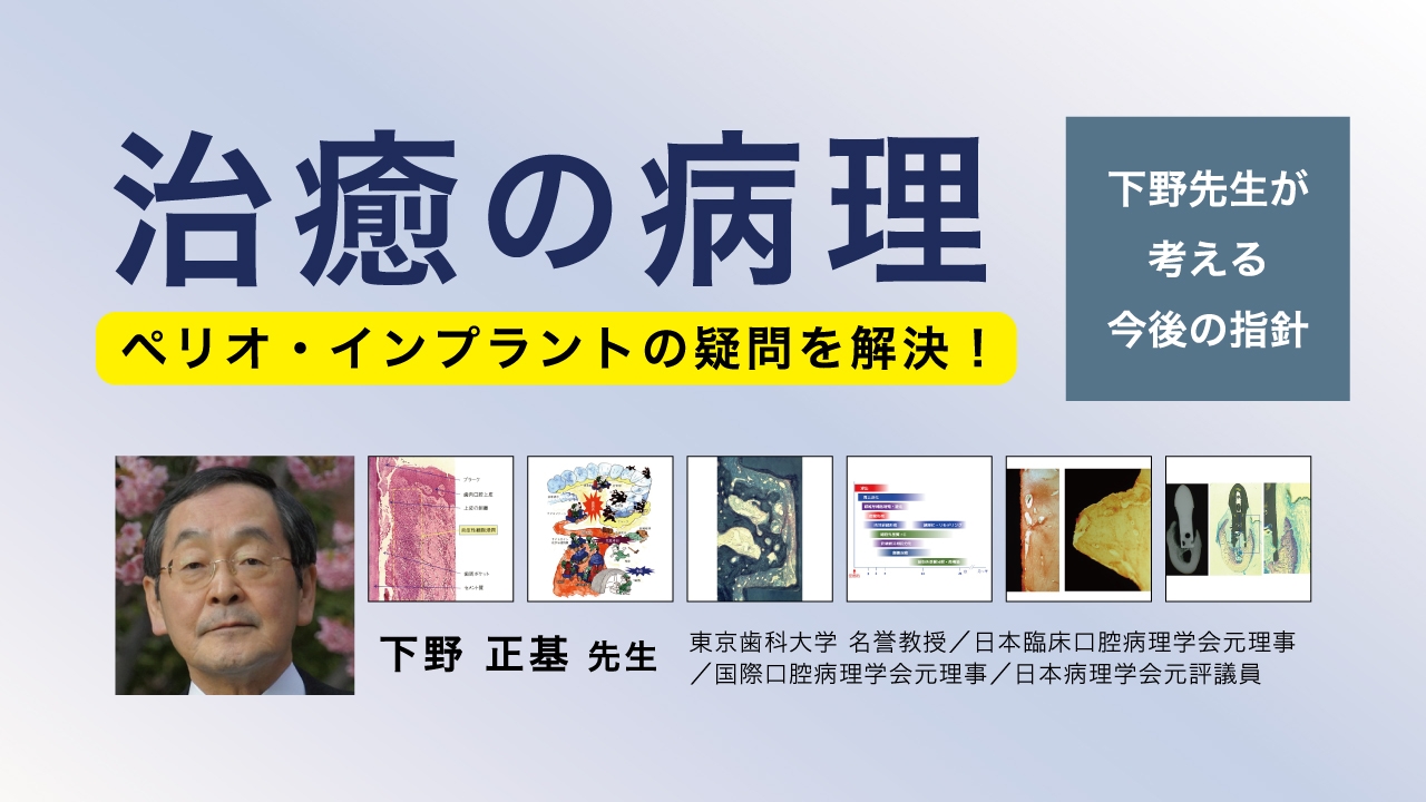 治癒の病理 ペリオ・インプラントの疑問を解決!~下野先生が考える今後の指針~の画像です